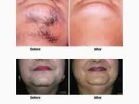 Visible Changes beauty and laser skin clinic 1075542 Image 2